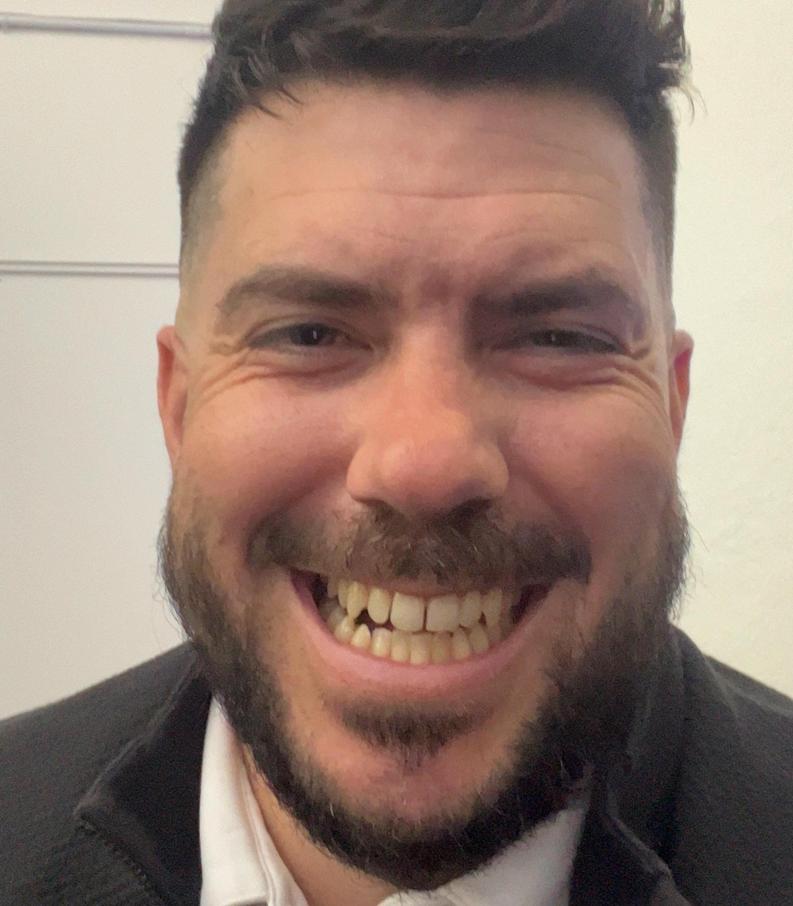 Before dental treatment